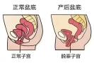 科学产后康复：重焕女性健康活力